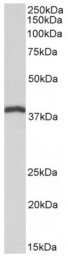 AP31421PU-N - Isocitric dehydrogenase beta / IDH3B