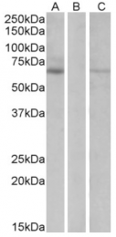 AP31559PU-N - Makorin-1