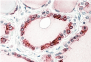 AP31571PU-N - Thyroid peroxidase (TPO)