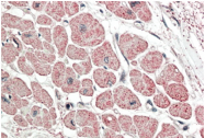 AP31699PU-N - Atrial Natriuretic Factor (ANF)
