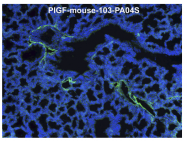 AP31725PU-L - Placenta growth factor / PGF