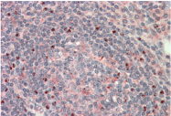 AP31837PU-N - CTDSP1