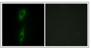AP31869PU-N - ACVRL1 / ALK1