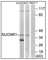 AP31872PU-N - Succinate receptor 1 / GPR91
