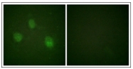 AP31873PU-N - Aurora kinase B