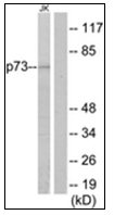 AP31883PU-N - Tumor protein p73 (TP73)