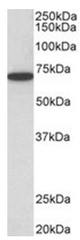 AP31951PU-N - HDAC1