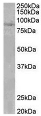 AP31953PU-N - SETDB2 / CLLD8