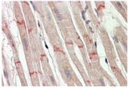 AP31969PU-N - Desmoplakin