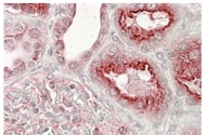 AP31975PU-N - RNF108 / VPS11