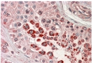 AP31980PU-N - XAGE-1 / G antigen family D member 2