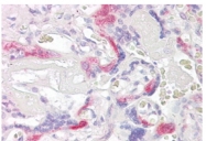 AP31981PU-N - PHLDA2 / TSSC3