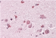 AP31984PU-N - ARHGAP3 / CHN2