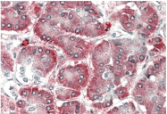 AP31988PU-N - SCYE1 / EMAP2