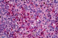 AP31997PU-N - CD191 / CCR1
