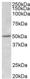 AP32006PU-N - Estrogen receptor beta