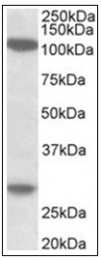 AP32009PU-N - Ubinuclein 1/2 (UBN1/UBN2)