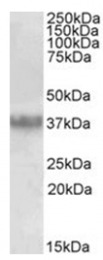 AP32025PU-N - Apolipoprotein J / Apo J