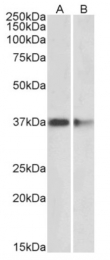 AP32026PU-N - PCNA