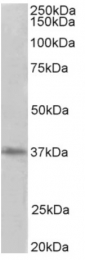 AP32026PU-N - PCNA