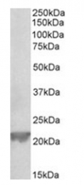 AP32027PU-N - Glutathione peroxidase 1 / GPX1