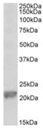 AP32028PU-N - Glutathione peroxidase 1 / GPX1