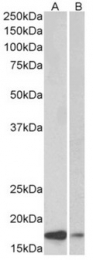 AP32035PU-N - Alpha-Synuclein / SNCA