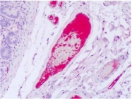 AP32047PU-N - von Willebrand factor (VWF)