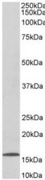 AP32059PU-N - 6CKine / CCL21