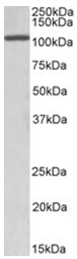 AP32065PU-N - CEBPZ / CBF2