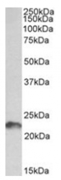 AP32068PU-N - Leukemia inhibitory factor