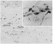 AP32076PU-N - Agouti-related protein / AGRP