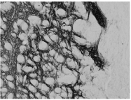 AP32079PU-N - Proenkephalin-A (PENK)
