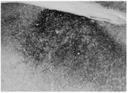 AP32079PU-N - Proenkephalin-A (PENK)