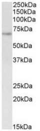AP32140PU-N - UBASH3A / STS2