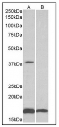 AP32143PU-N - CD57 / B3GAT1