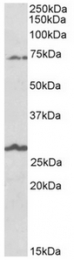 AP32145PU-N - SLC6A12