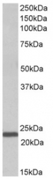 AP32152PU-N - Interleukin-15 / IL15