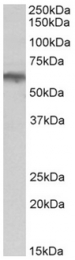 AP32156PU-N - Alpha-1B adrenergic receptor / ADRA1B