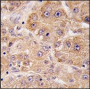 AP32185PU-N - UVRAG