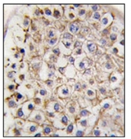 AP32195PU-N - LC3B
