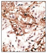 AP32196PU-N - MAP1LC3C