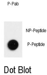 AP32197PU-N - LC3B
