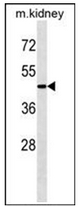 AP32201PU-N - Autophagin-2