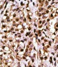 AP32201PU-N - Autophagin-2