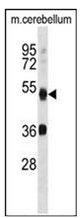 AP32206PU-N - APG4B / ATG4B