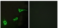 AP32213PU-N - Endothelin A receptor