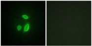 AP32216PU-N - Separin / ESPL1