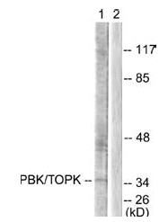 AP32219PU-N - PBK / TOPK