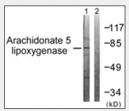 AP32220PU-N - ALOX5 / LOG5